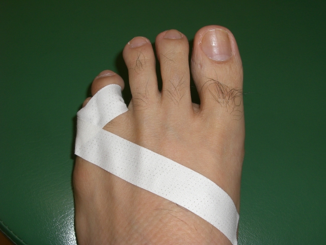 足の指 捻挫 骨折 見分け方